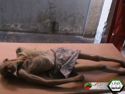 Palestinians – and Syrians - in Yarmouk are killed in a myriad of ways, including starvation. (via Social Media)