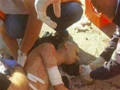 wounded_palestinian_socialmedia