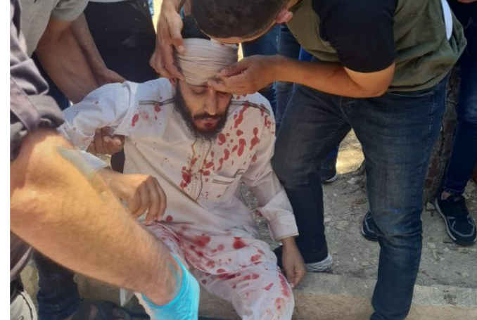 Injured al-aqsa